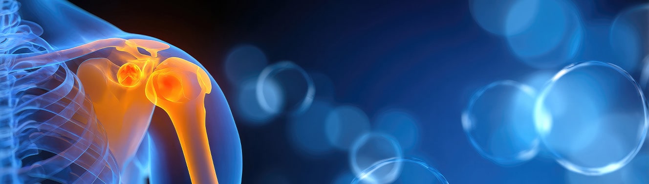 Personal Injury Lawyer Commercial: The Complete Guide to Creating High-Converting Legal Advertising